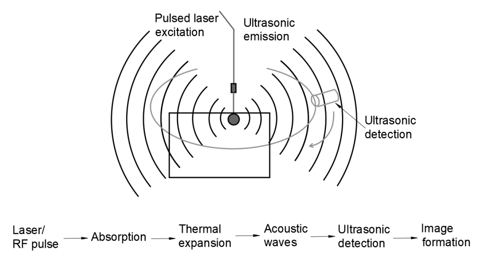 Photoacoustic microscopy uses both light and acoustic methods to produce an image more detailed than could be produced by either method alone